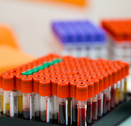 Blood Test Result Abnormalities